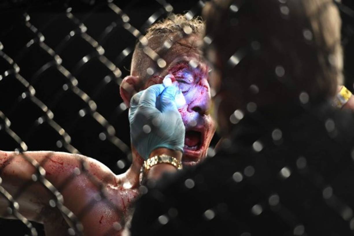 Uno de los combates más feroces que se vivieron en este evento fue el enfrentamiento entre Niko Price y Vicente Luque en lo que fue la tercera pelea de las preliminares. “El asesino silencioso”, como se lo conoce dentro del mundo de las MMA conectó un zurdazo en el ojo de Price que fue fulminante, no solo por el fuerte impacto sino también por las secuelas.