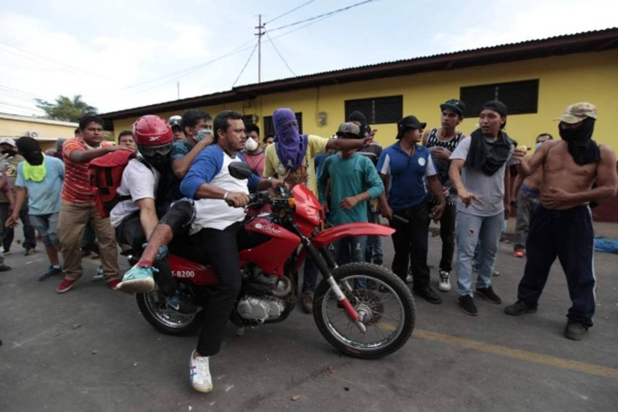 Un médico de las brigadas voluntarias que trabajan en Masaya que pidió no ser identificado dijo a la agencia de noticias AFP que sólo en su puesto sanitario llegaron más de 25 personas heridas, varias de ellas por impacto de bala.