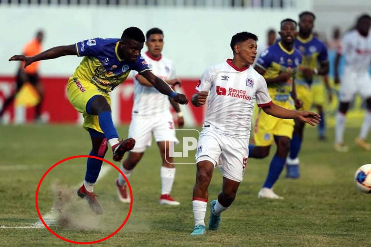 En esta imagen, se refleja el mal estado de la cancha del estadio Nacional.