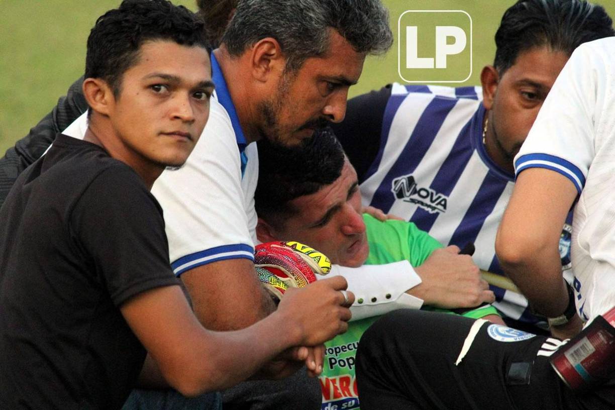 El portero del Victoria, Harold Fonseca, sufrió una lesión en su mano izquierda y acabó llorando.