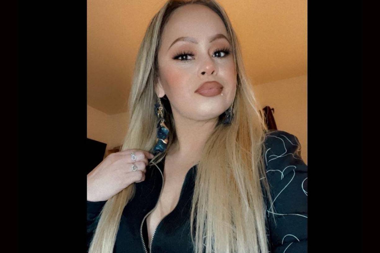 Los médicos descubrieron que se había adquirido una infección asociada a la bacteria Vibrio vulnificus.