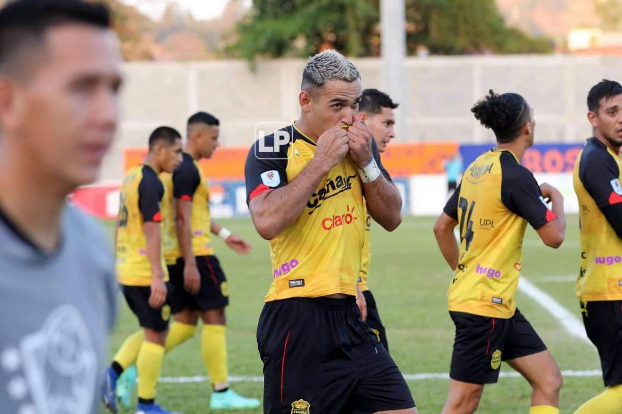 En el Día Mundial del Beso, Omar Rosas celebró besando el escudo del Real España.