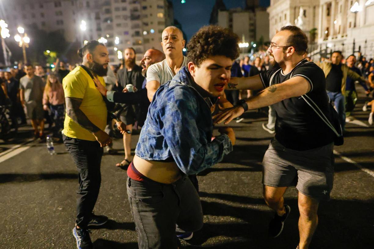 Desde la expresidenta Cristina Fernández hasta figuras del radicalismo, el plan de Milei para la reconstrucción de la economía argentina anunciado este miércoles está generando un fuerte rechazo político y social que va más allá del descontento expresado en las calles por las organizaciones sociales y grupos de ciudadanos que secundan de manera espontánea convocatorias en las redes sociales. 