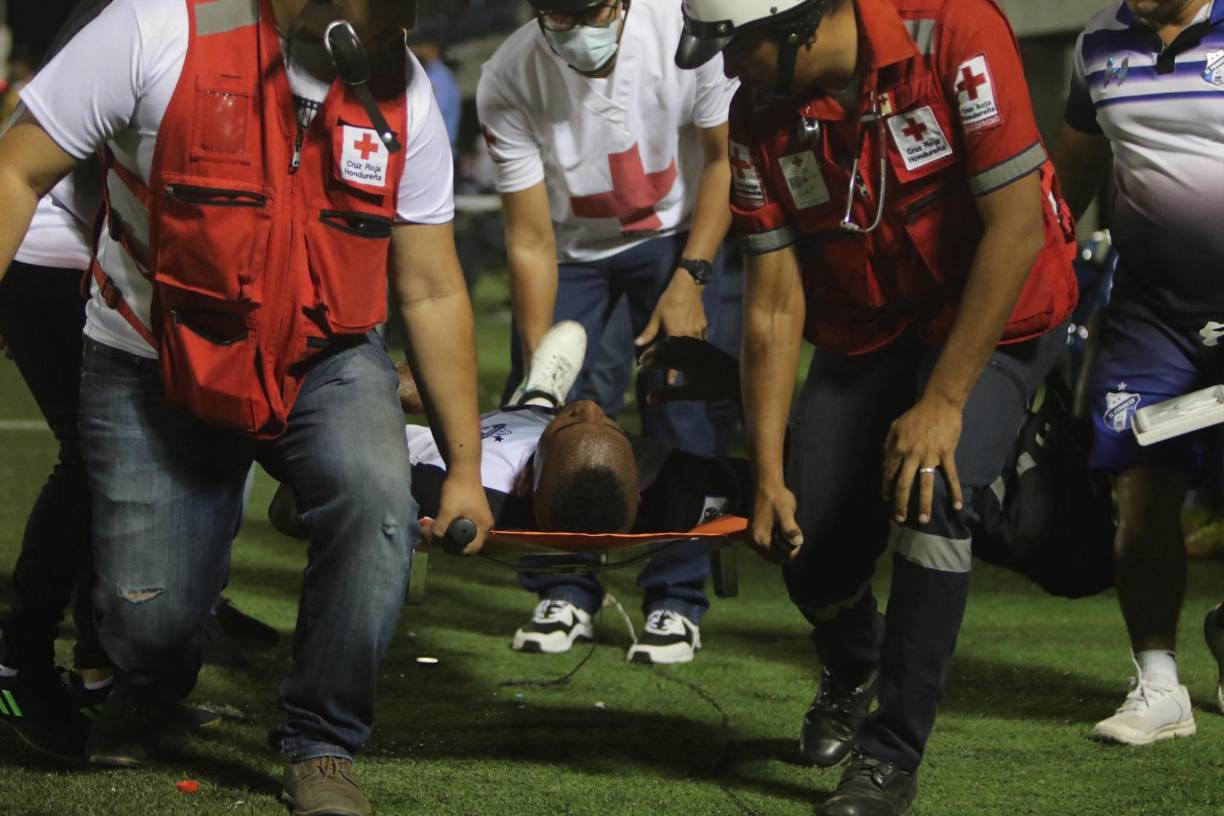 El jugador de Honduras Progreso fue atendido por los servicios médicos, quienes hicieron el procedimiento para trasladar al jugador fuera del terreno de juego.