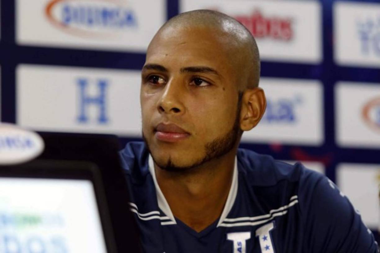 Así luce el ojo derecho de Eddie Hernández, provocado por aquel golpe que se llevó en un choque con el jugador brasileño Caue Fernandes del Marathón.