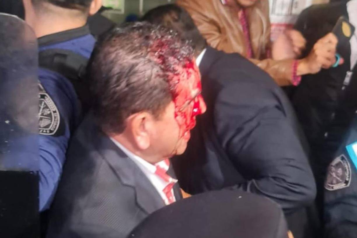 Las sesiones ordinarias en el Parlamento se suspendieron el 31 de agosto, pero el presidente del Parlamento ayer nombró una Comisión Permanente para que pueda continuar con las sesiones ordinarias desde el 1 de noviembre al 24 de enero de 2024, tras un incidente violento en el exterior de ese poder del Estado, que dejó varios lesionados.