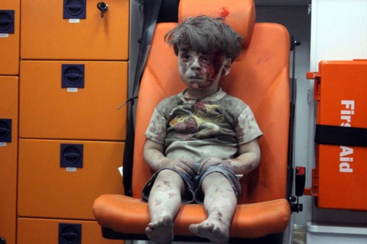 El niño Omran Daqneesh se convirtió en el rostro de la guerra en Siria al aparecer ensangrentado en una fotografía que le dio la vuelta al mundo.