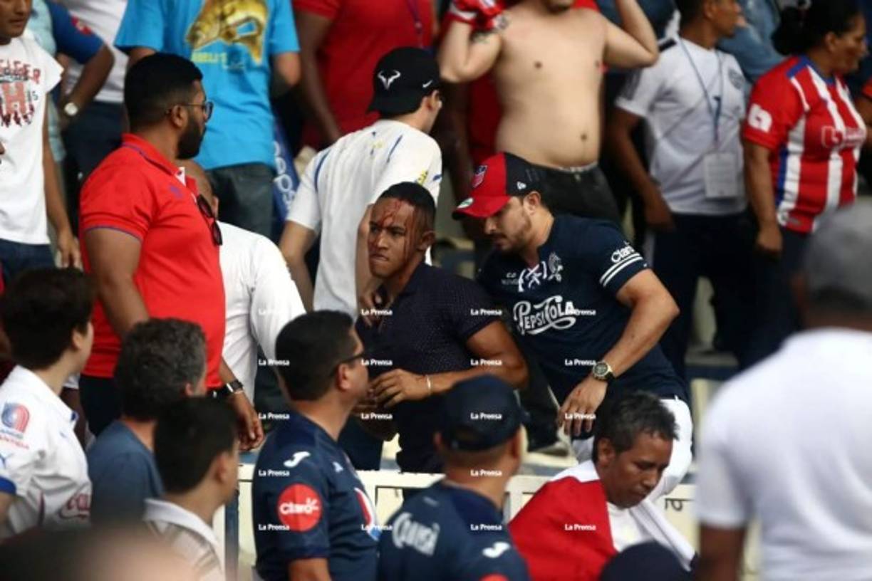 Un aficionado del Motagua también intentó calmar al joven que recibió una pedradra.