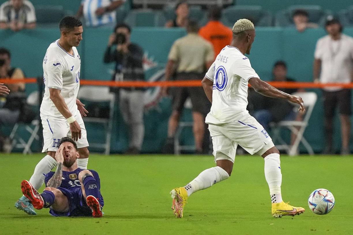 Messi, con gestos de dolor en su rostro luego de la entrada del hondureño.