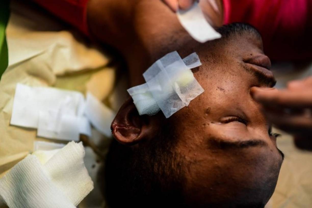 4. Crisis de salud<br/><br/>La escasez de medicamentos es de 85%, y de 95% para enfermedades crónicas, según la Federación Farmacéutica. <br/><br/>Enfermedades como la difteria -erradicada hace 24 años- reaparecieron. Hay brotes de tuberculosis, malaria y sarampión.<br/>