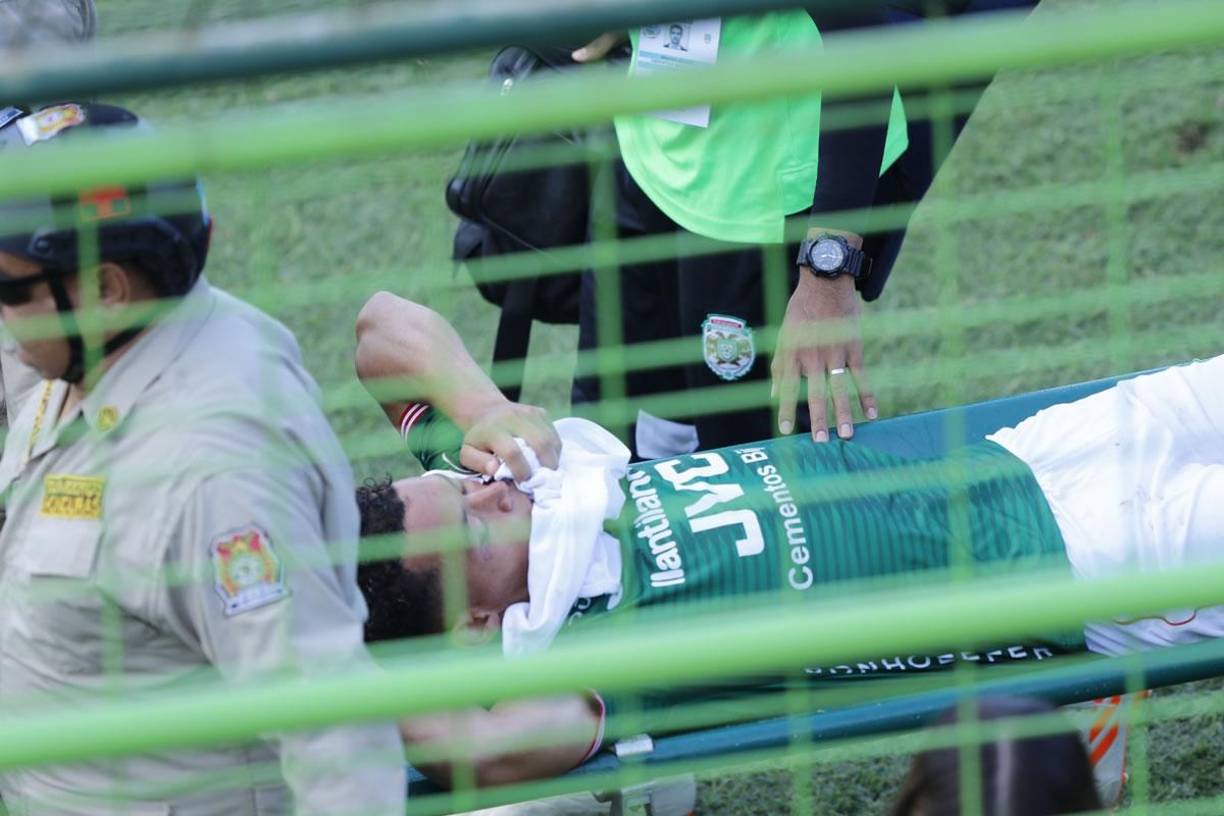 Damin Ramírez fue otro de los lesionados que tuvo Marathón en el partido. Tuvo que abandonar el campo en camilla tras un golpe en el minuto 59. Entró Tomás Sorto por él.