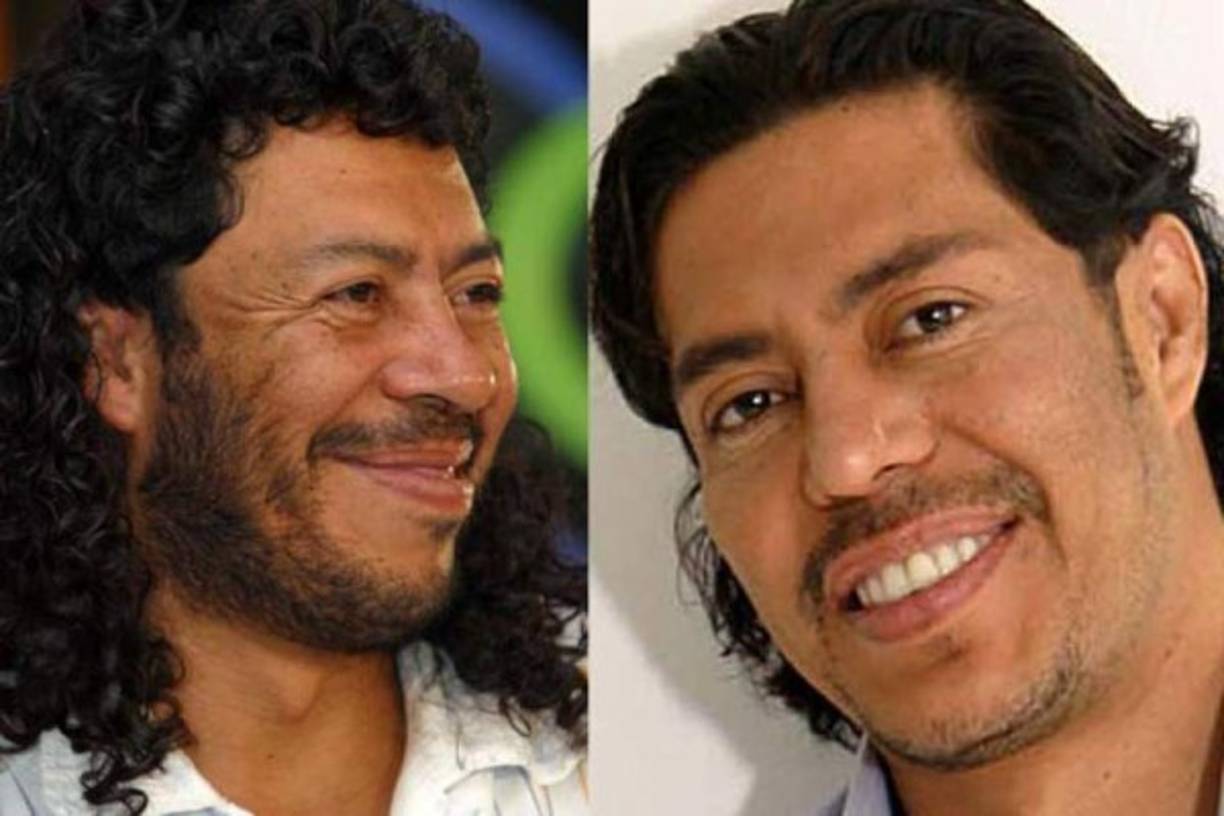 René Higuita fue sometido a cirugías y meses después se quejó del cambio por las secuelas. Se hizo un tratamiento con láser para quitarle las manchas del rostro. También hicieron algunas modificaciones en la cara y esto le impedía abrir la boca.