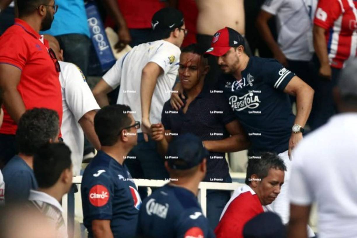 Un aficionado recibió una pedrada en el sector de silla, lo que le provocó un corte en la cabeza y terminó sangrando.