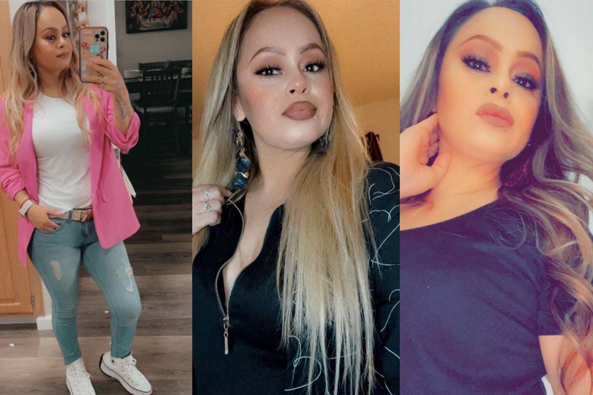 Laura Barajas perdió sus extremidades después de consumir tilapia poco cocida.