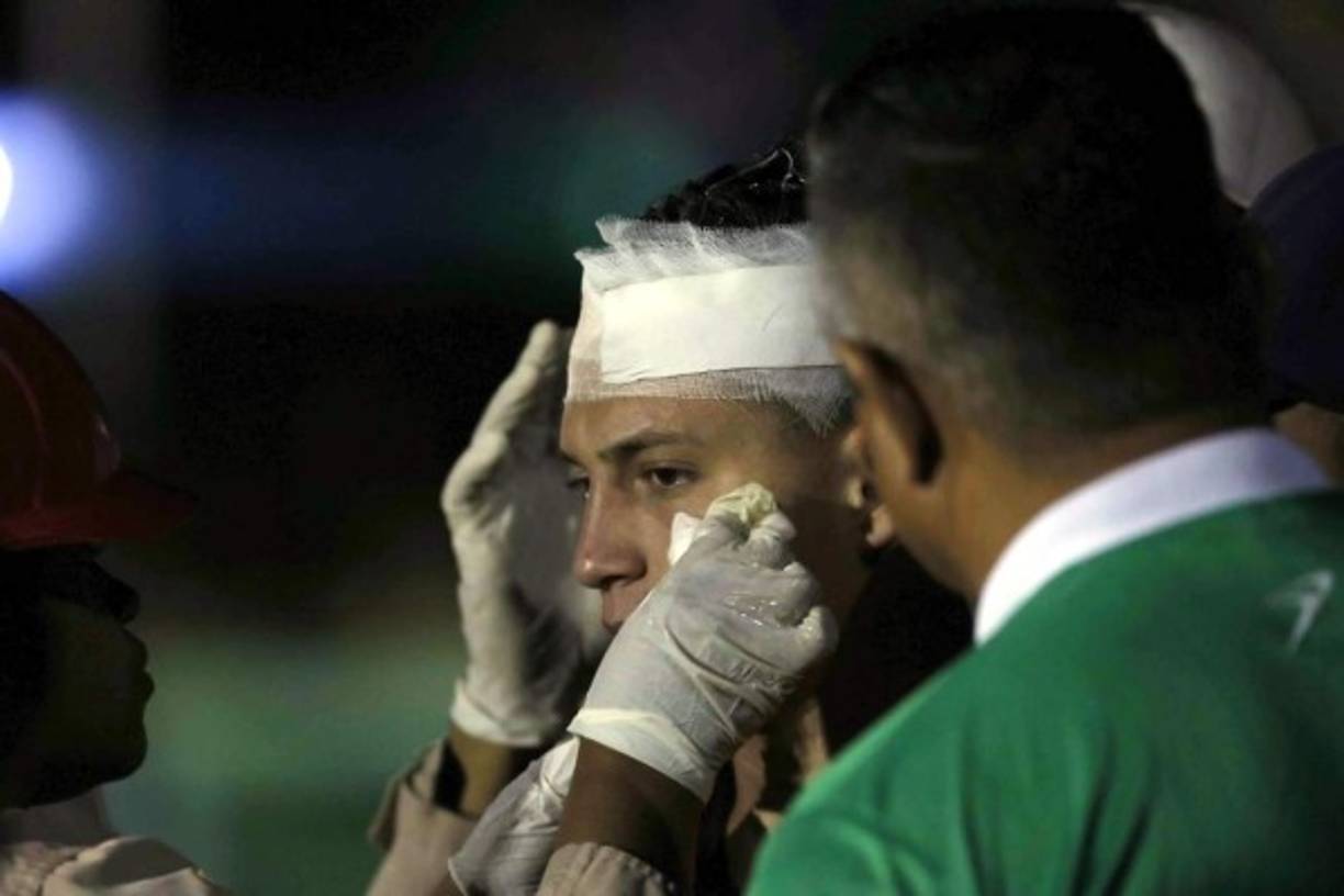 El futbolista del Platense tuvo que ser vendado tras el duro cervezazo que recibió en la cabeza.