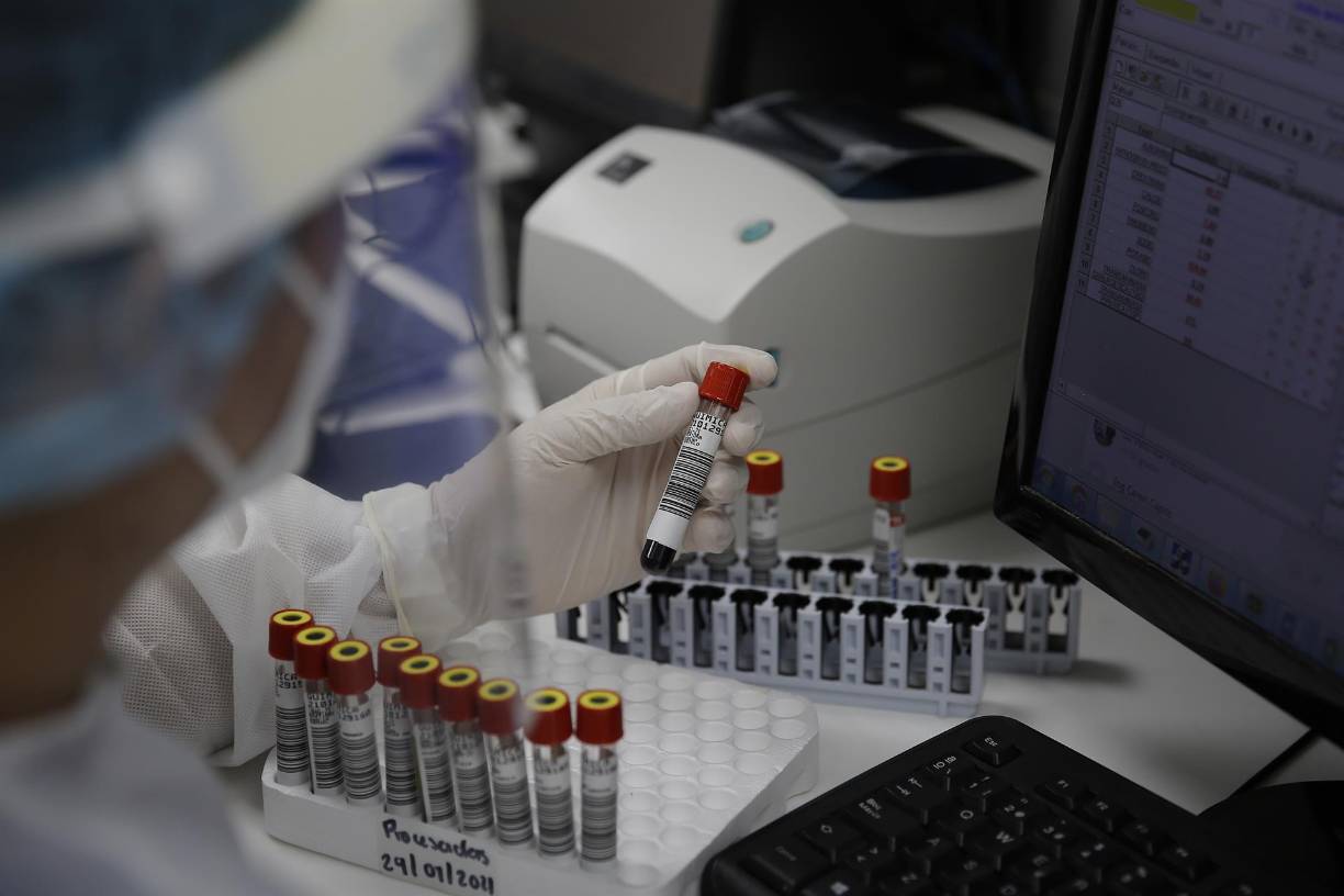 Viruela del mono: ¿Qué es, cómo se transmite y qué países han detectado casos?