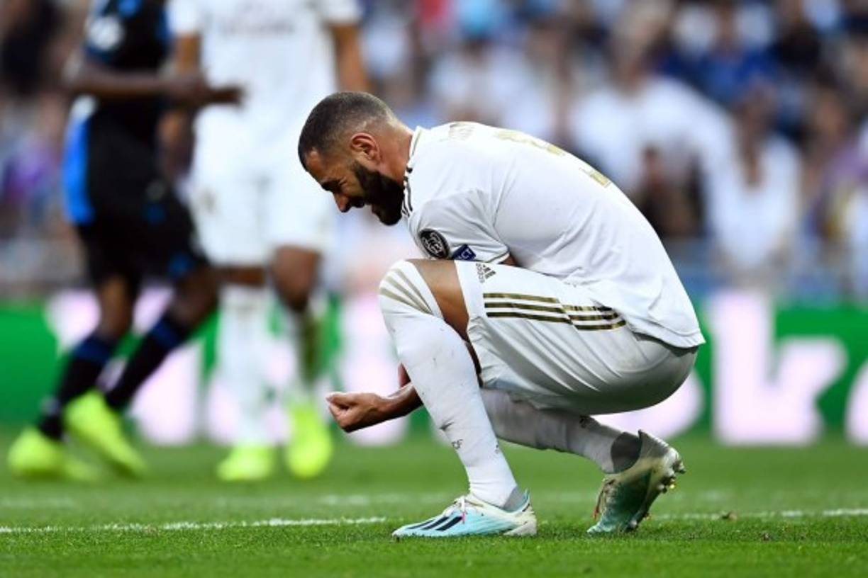 El dolor de Karim Benzema tras llevarse un golpe en la mano izquierda.