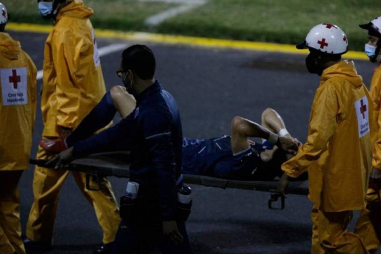 Roberto Moreira salió del campo en camilla tras lesionarse la rodilla izquierda. Una mala noticia para Motagua.