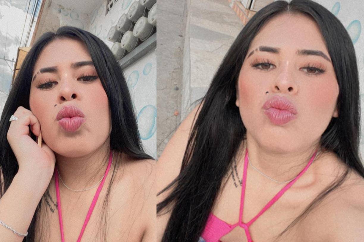 Ella iba como pasajera en una motocicleta cuando ocurrió el accidente.