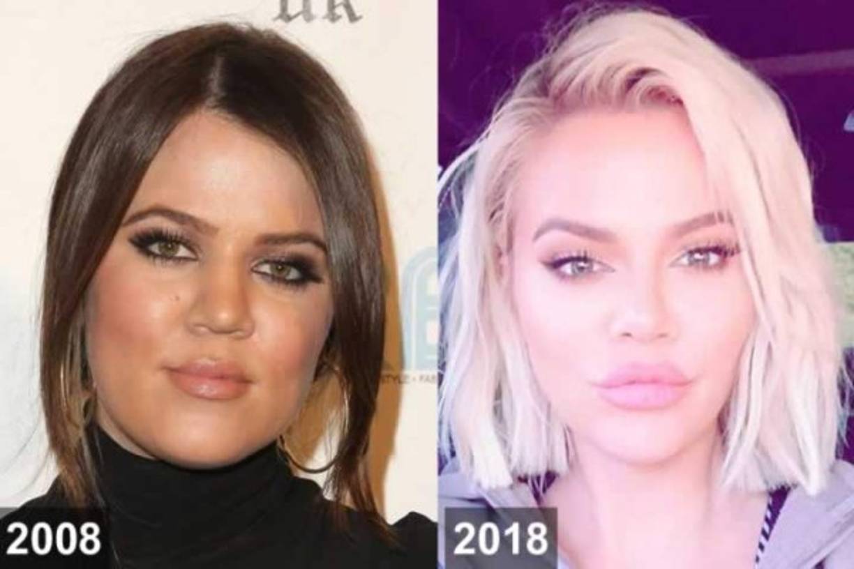 Cuando Keeping Up with the Kardashians debutó por primera vez en E! en 2007, los espectadores fueron presentados a Kourtney, Kim y Khloe Kardashian. Debido a sus diferencias físicas, Khloé pronto fue llamada 'la hermana gorda' y sufrió críticas por su aspecto.