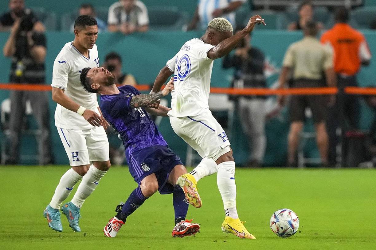 Leo Messi cayó al suelo con gestos de dolor tras la fuerte falta de Deiby Flores.