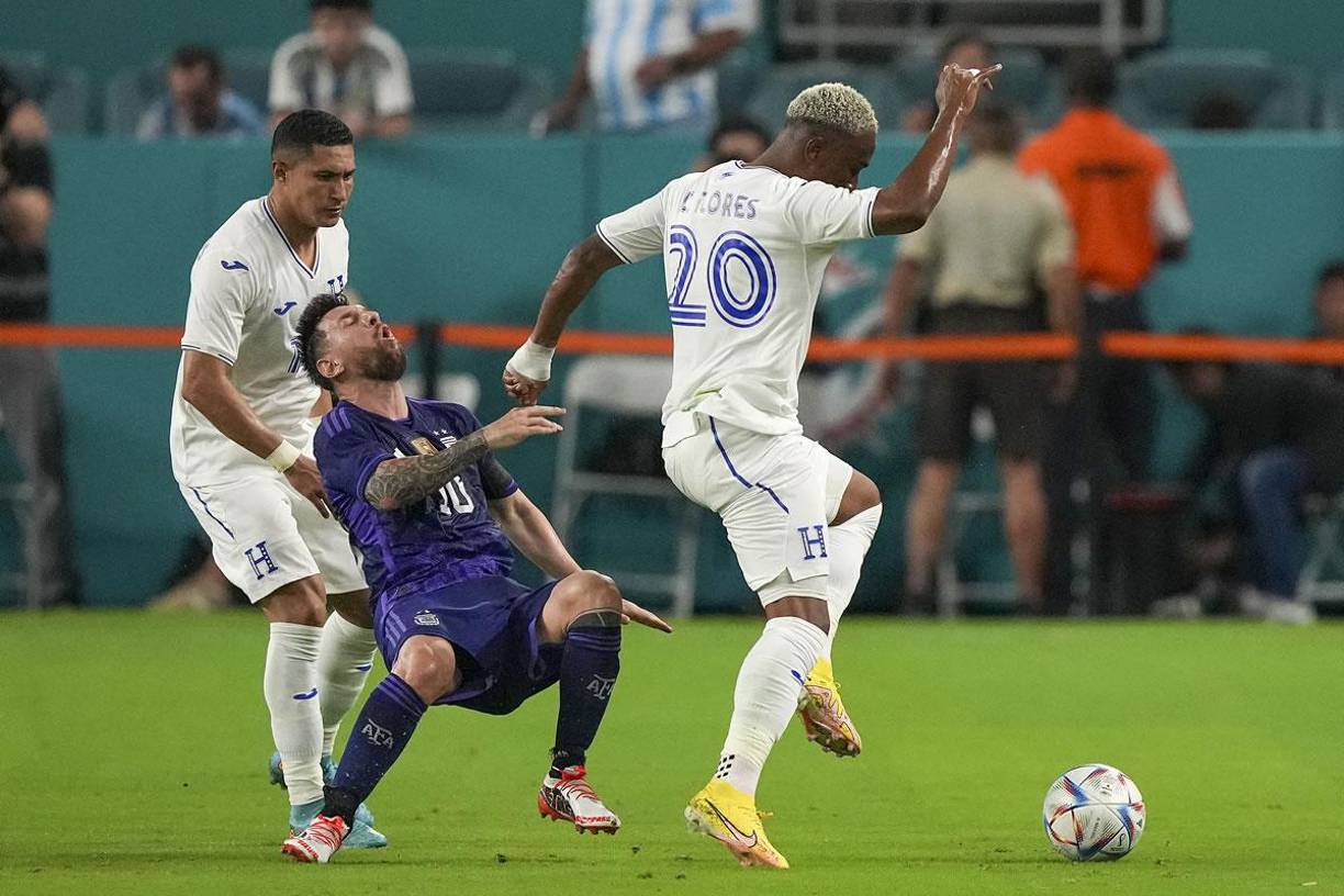 Leo Messi cayó al suelo con gestos de dolor tras la fuerte falta de Deiby Flores.