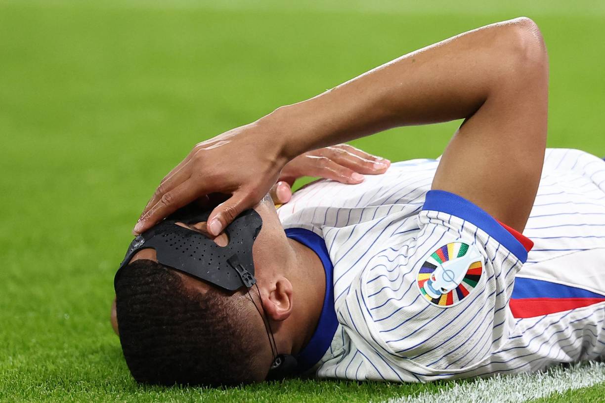 La jugada se dio cuando Bernardo Silva remató y el balón le pegó en la cara al francés.