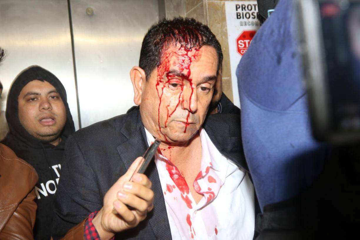 El diputado Toño Rivera fue trasladado a un centro asistencial