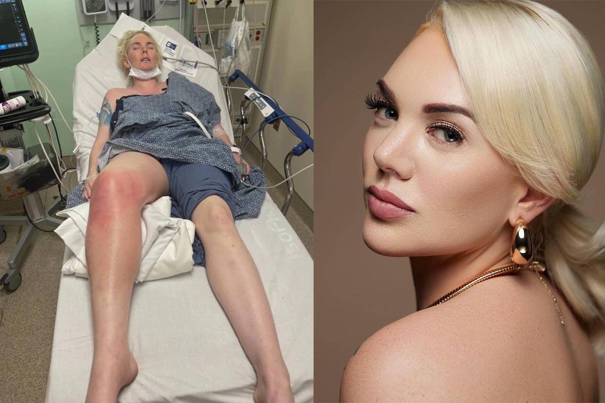  La meta que tiene para reunir es de 52 mil dólares, de los cuales lleva más de 38 mil. 