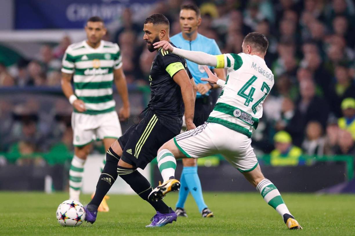 Karim Benzema fue la mala noticia del Real Madrid al salir lesionado en el primer tiempo contra el Celtic.