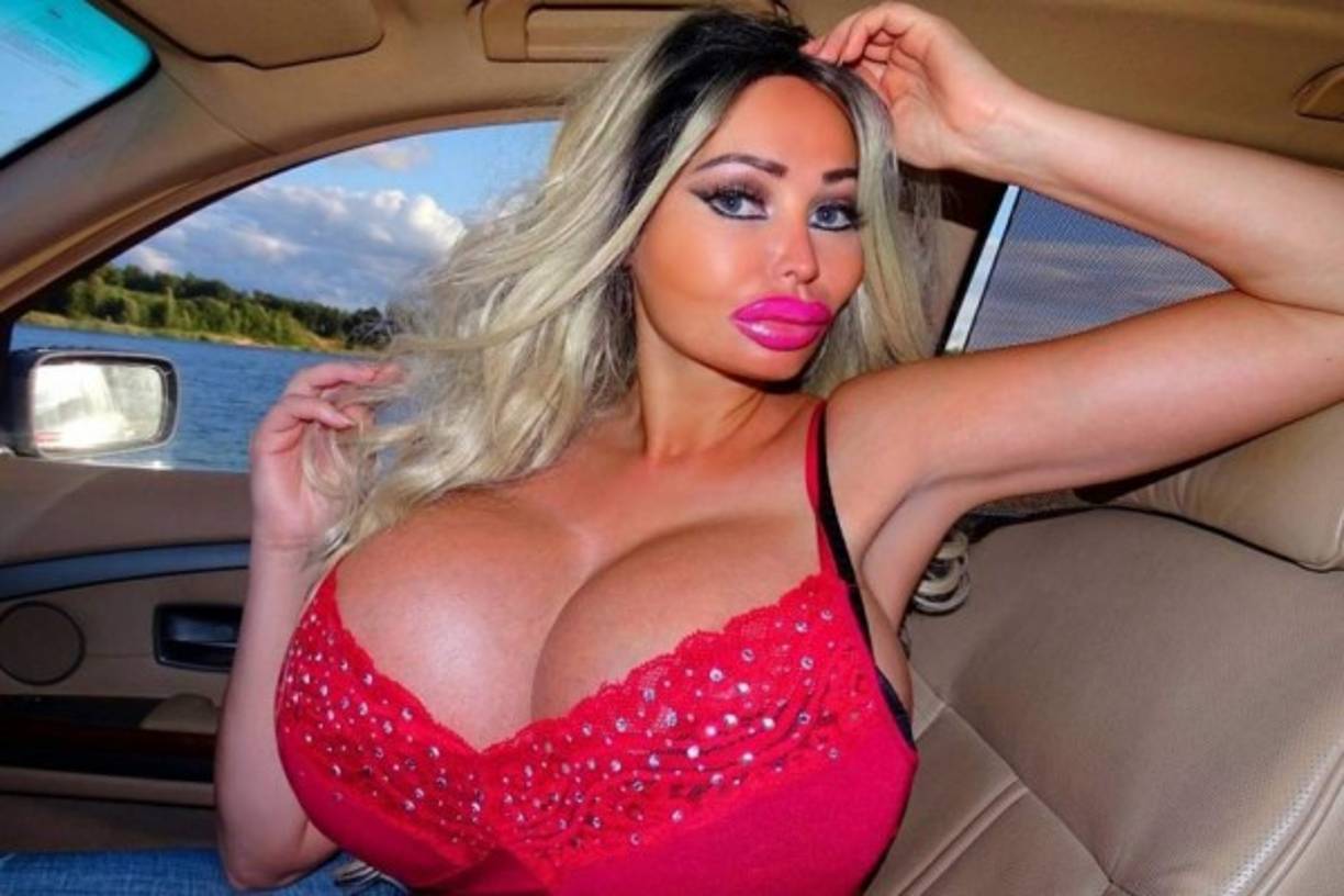 La modelo ha gastado más de 30 mil dólares en operaciones para modificar su cuerpo.