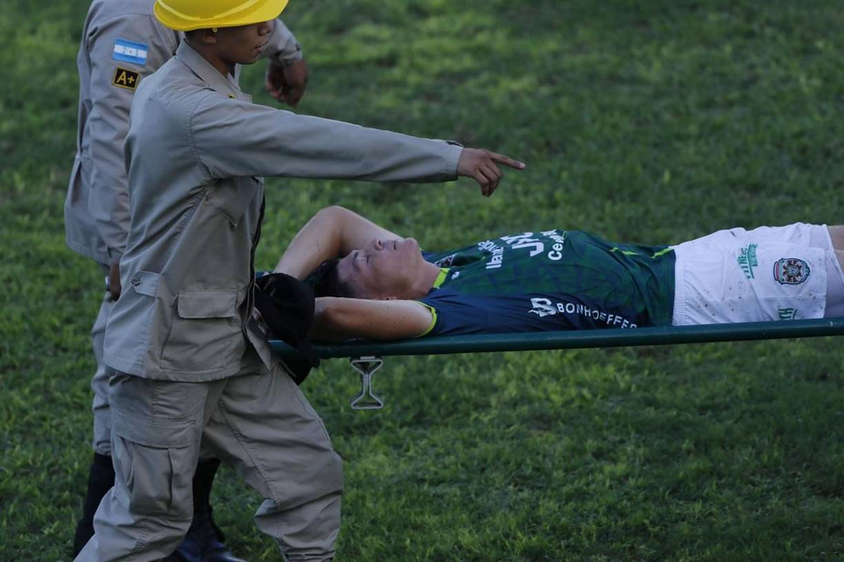 La mala noticia para el Marathón en el partido ante la Real Sociedad fue Francisco ‘Chelito’ Martínez, quien tras recibir una dura falta tuvo que salir del campo en camilla.