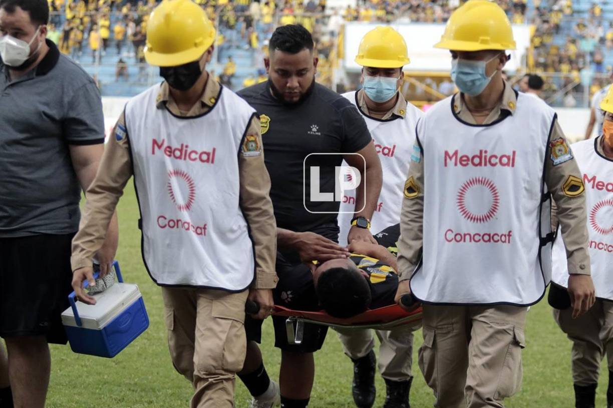 El defensa del Real España, Getsel Montes, salió del campo en camilla por lesión y se fue llorando.