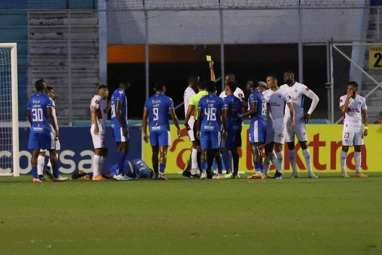 El árbitro Saíd Martínez tuvo que poner orden en varios momentos del partido y sacó tarjetas amarillas.