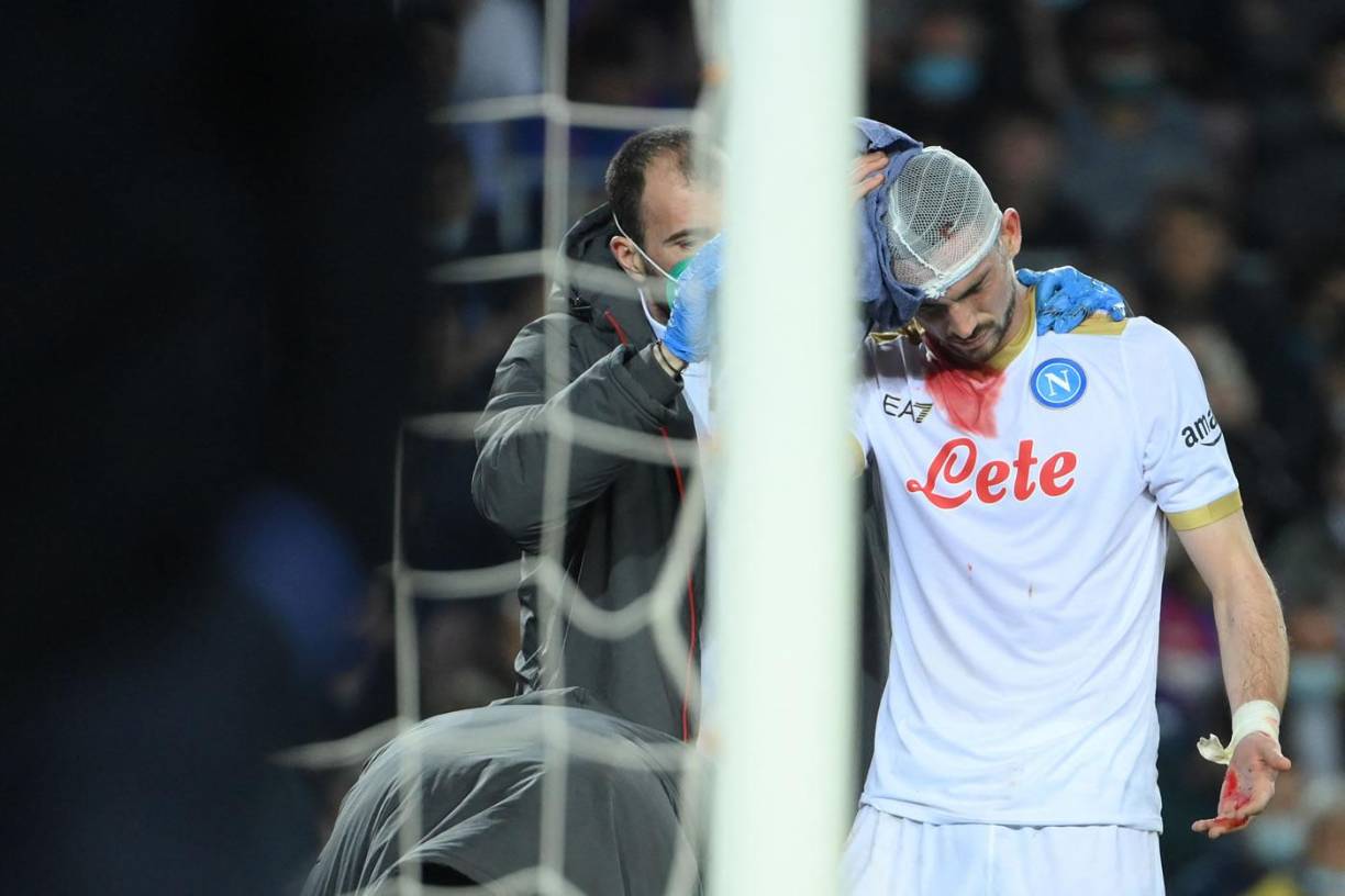 El español del Napoli, Fabián Ruiz, sufrió un duro golpe en su cabeza tras una acción con Gavi y terminó sangrando en pleno campo.