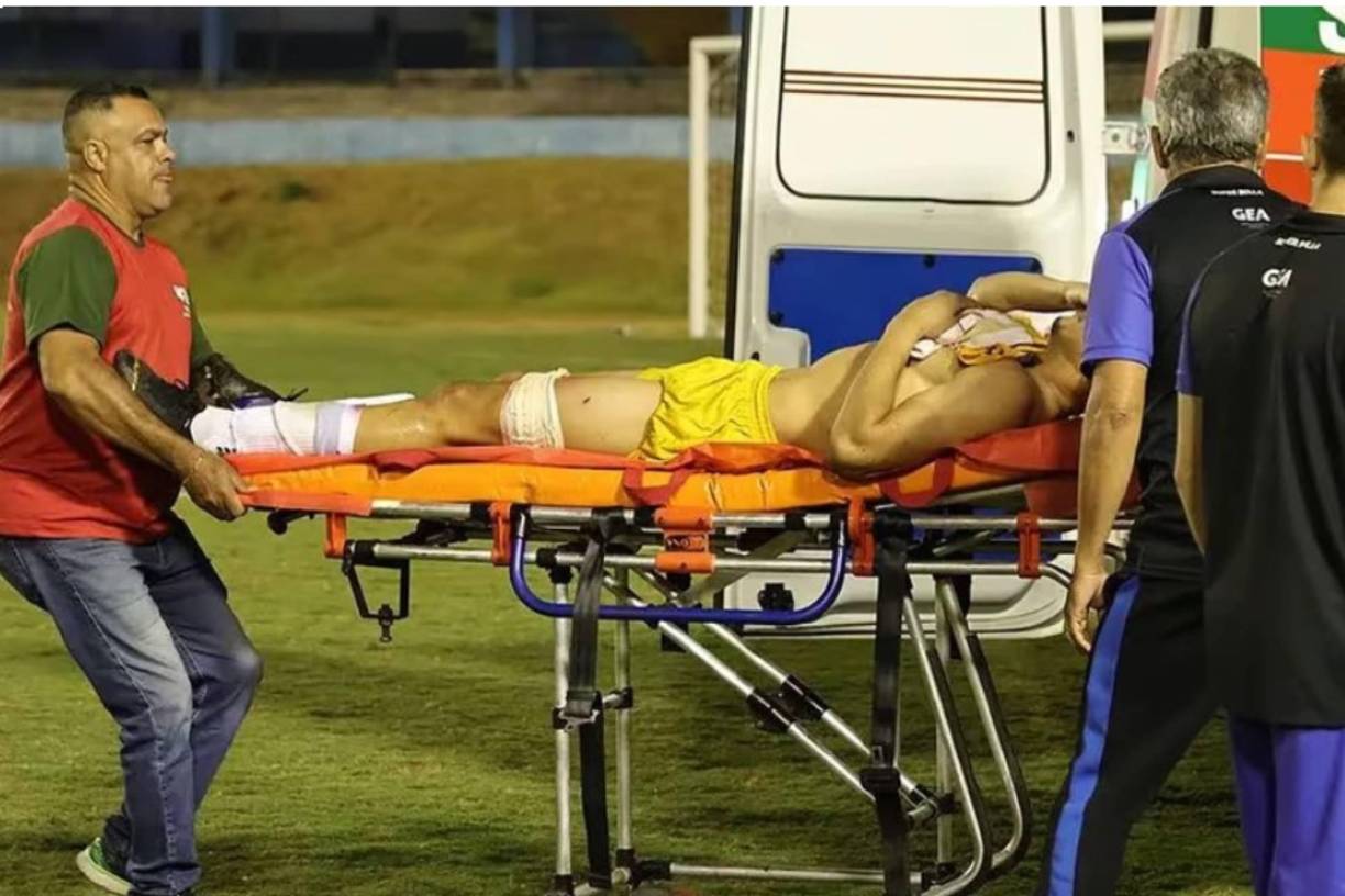 La víctima fue Ramón Souza, arquero de Gremio, quien resultó herido en la zona del aductor y fue asistido por el cuerpo médico dentro del campo de juego, donde se produjo el escándalo. Sus compañeros, en cambio, lograron escapar. “Después de recibir el tratamiento, el portero no está arriesgando su vida ni perdiendo su pierna lesionada”, informaron desde el club.
