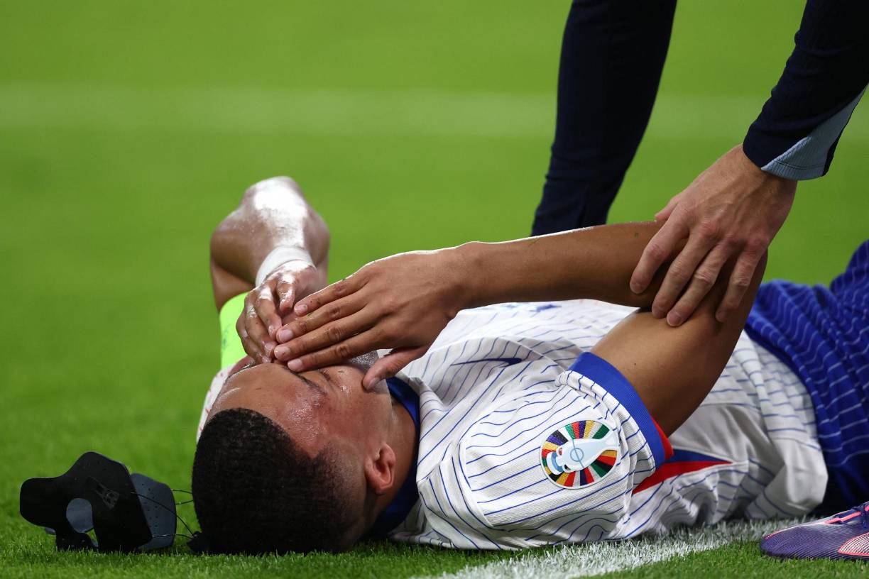 En la primera parte, Mbappé dio el susto tras llevarse un golpe en la máscara que ha portado desde la jornada 2 de la Eurocopa y se retorció de dolor en el campo.
