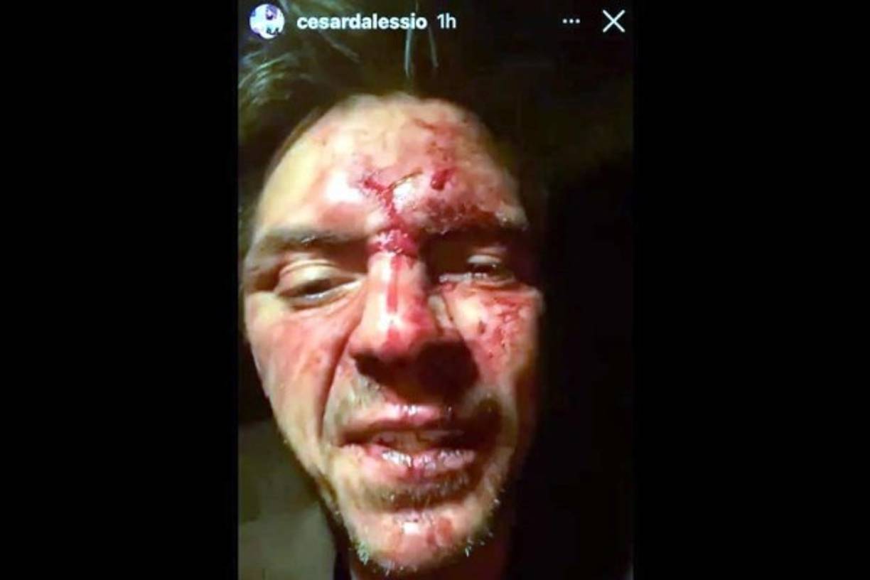 'Tres tipos se le fueron encima golpeándolo y pateándole la cabeza, fue horrible, pudieron haberlo matado; tal y como le dijeron los médicos, una patada mal dada en el cerebro y ahí queda', añadió.<br/>