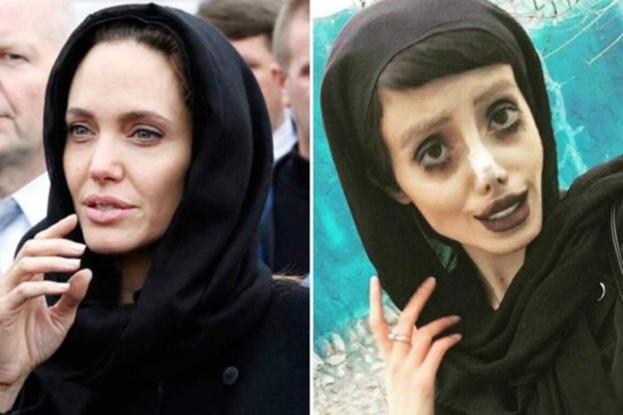 La joven intentó parecerse a su ídolo Angelina Jolie, pero en su lugar es tildada de 'zombie'.