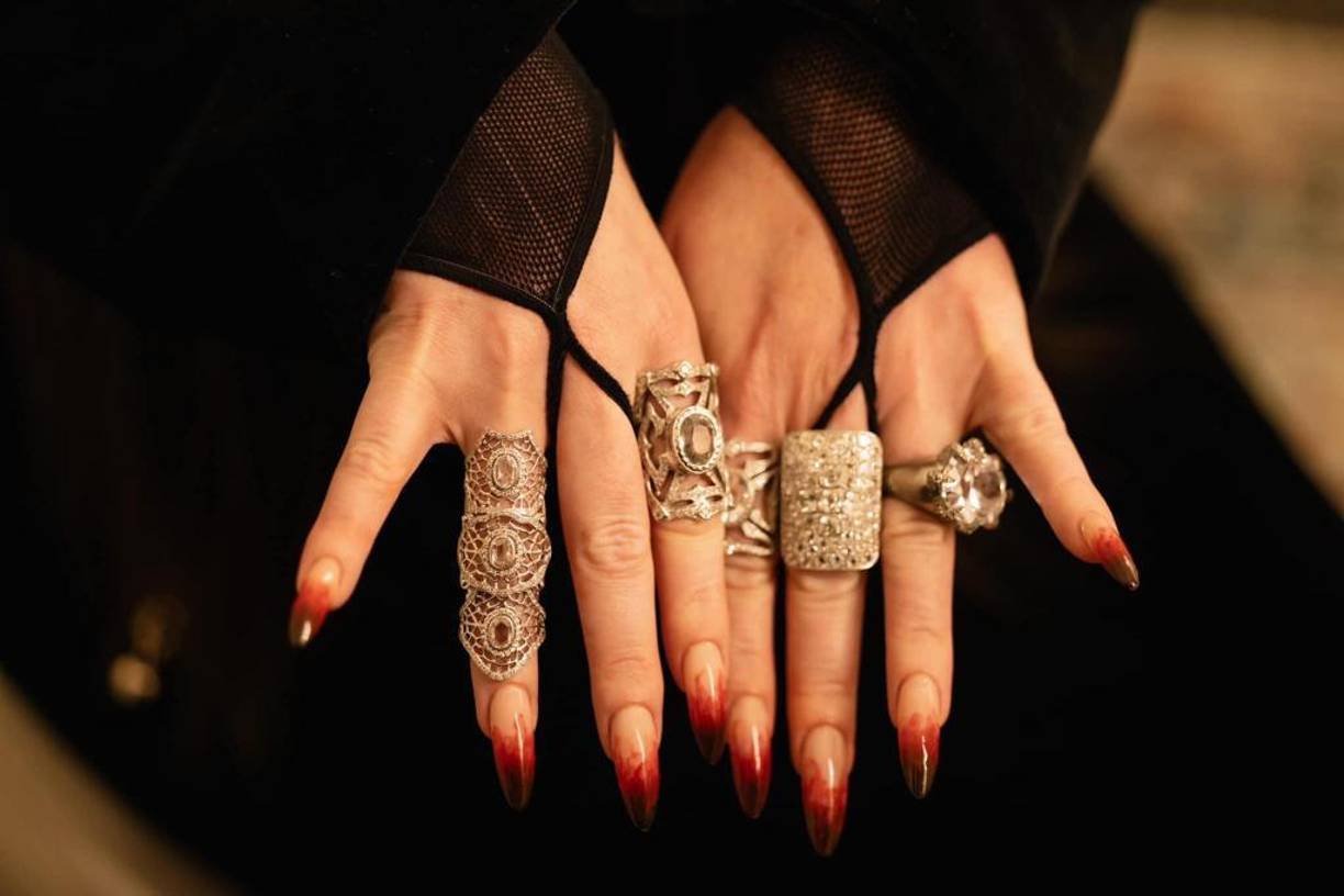 Asimismo en sus redes sociales mostró como lucían sus manos. 