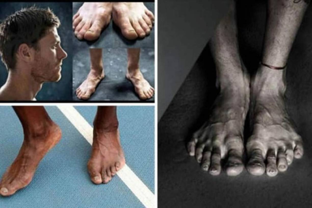 Es algo en lo que casi nadie se fija, pero sin duda que es tema interesante para cualquier persona. ¿Han visto ustedes los pies más feos de los deportistas más famosos del mundo? Pues aquí haremos un recuento de ello.