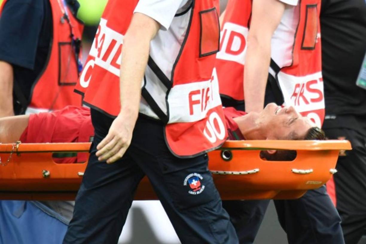 Cristiano Ronaldo salió del campo en camilla. No pudo más tras recibir una fuerte entrada de Payet.