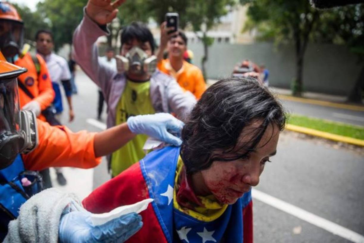 Una estudiante resultó levemente herida, según dijo, por el roce de una bomba lacrimógena y fue atendida por paramédicos, en tanto que un policía también fue asistido por una lesión en la boca.