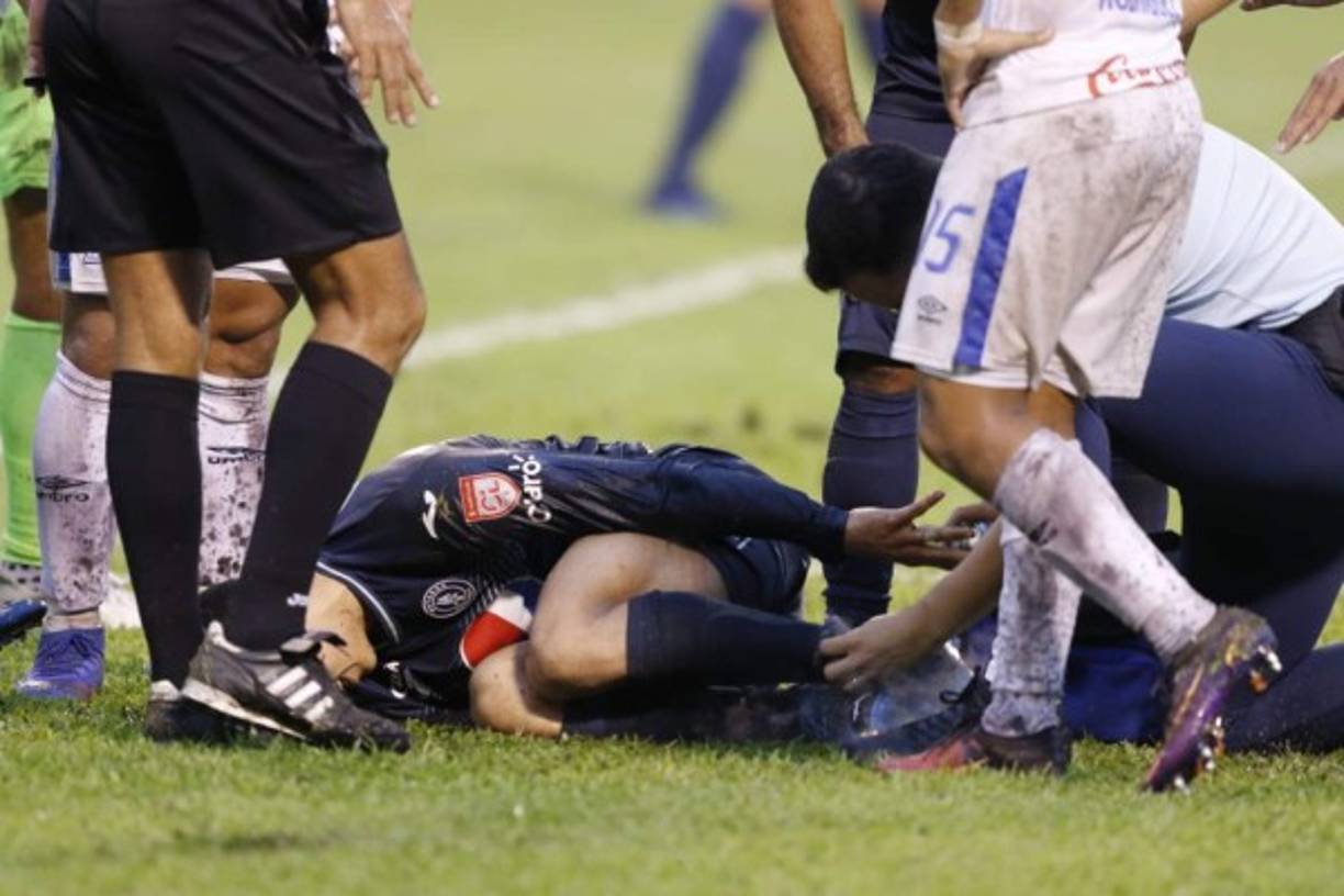 Los gestos de dolor de Kevin López tras la falta de Yustin Arboleda.