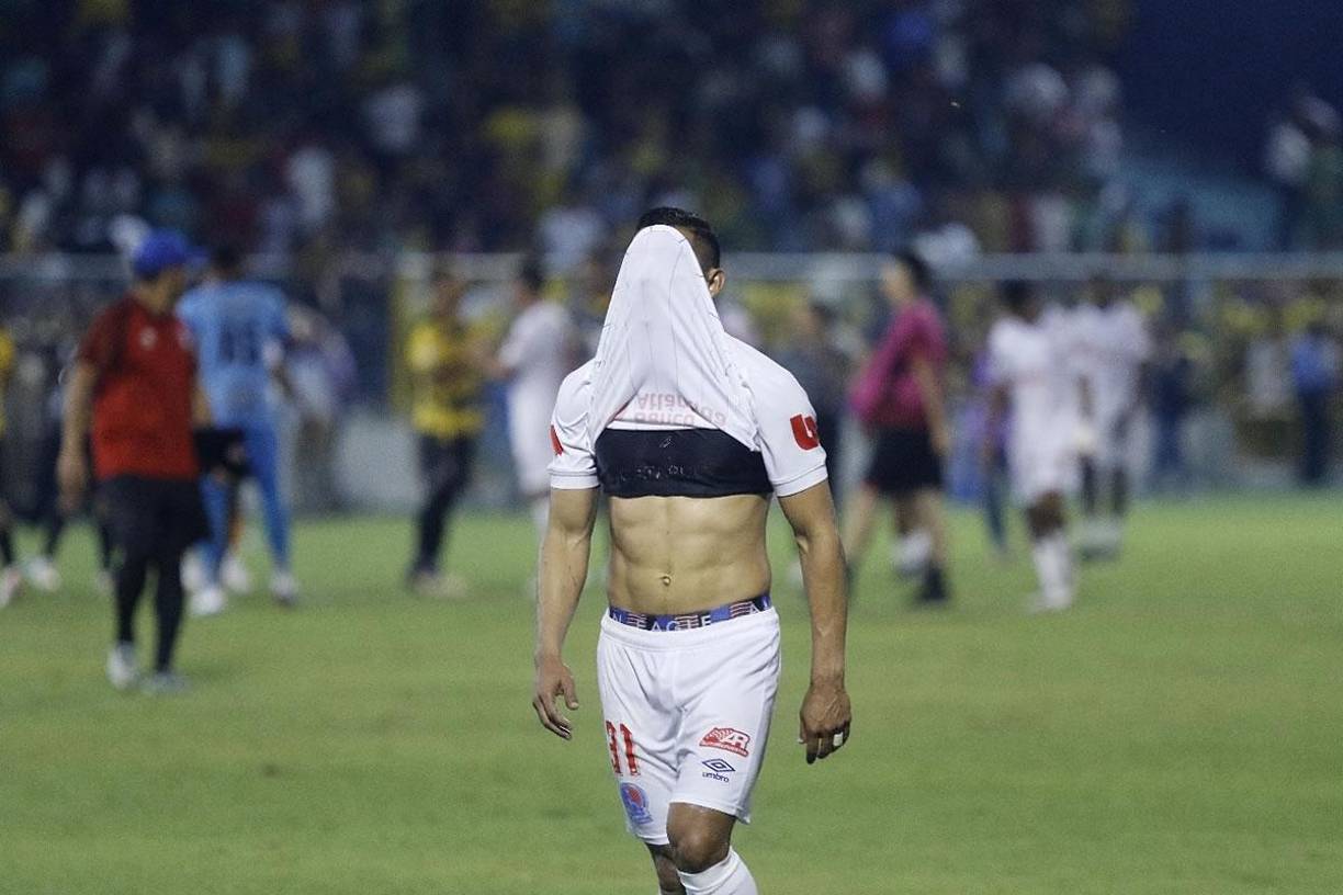 Carlos ‘Mango‘ Sánchez se tapó el rostro con la camiseta tras derrota de Olimpia en el clásico contra el Real España.
