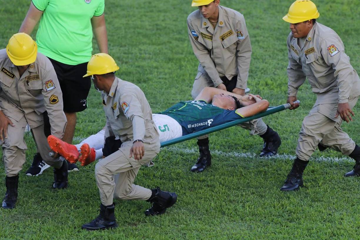 Francisco ‘Chelito’ Martínez no pudo seguir en el campo y tuvo que salir en camilla con ayuda de los bomberos. Entró en su lugar Allan Banegas, en los últimos minutos del partido.