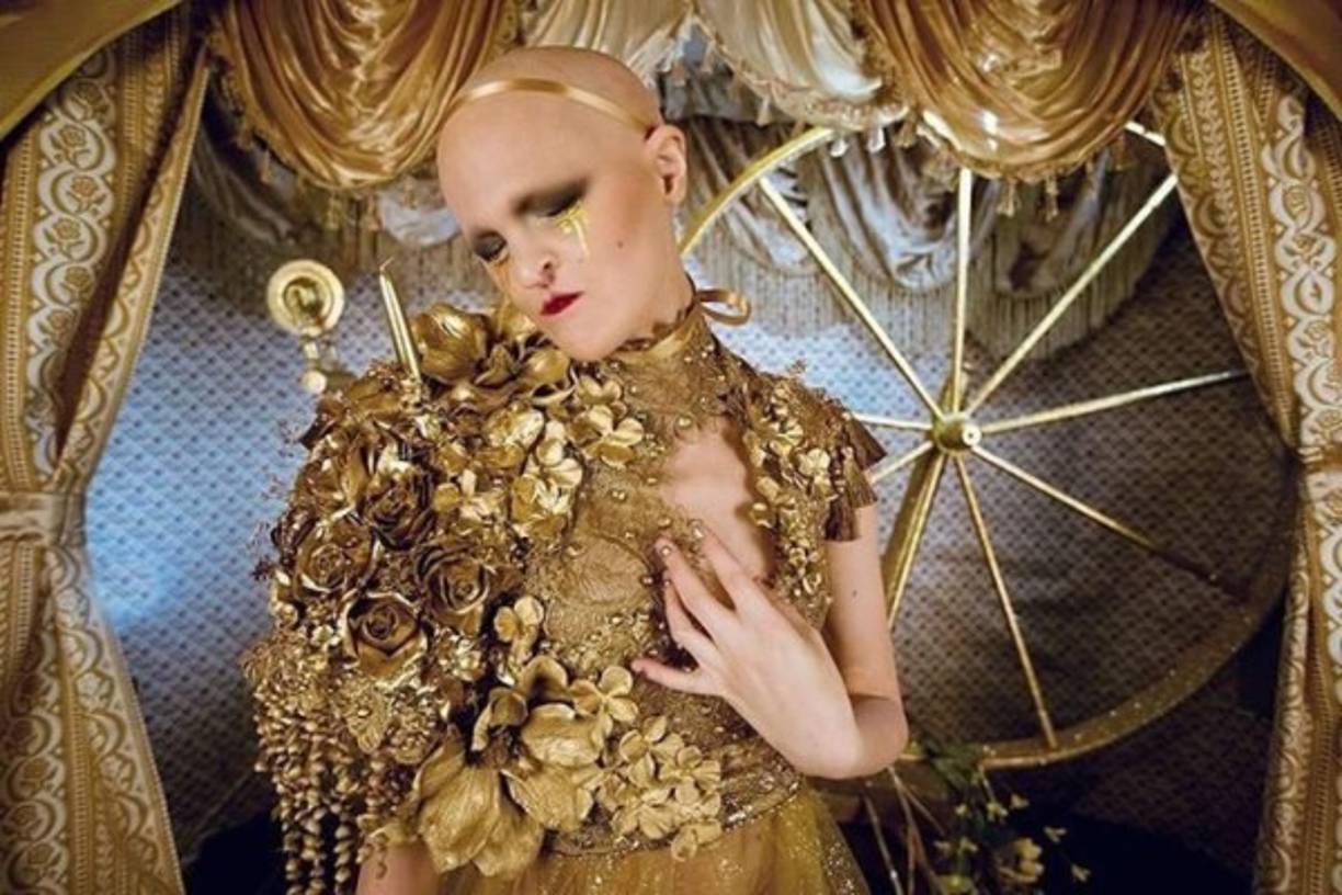 Por su aspecto inusual fue difícil iniciar una carrera, pero ahora es exactamente su imagen la que atrae contratos en la industria de la moda.