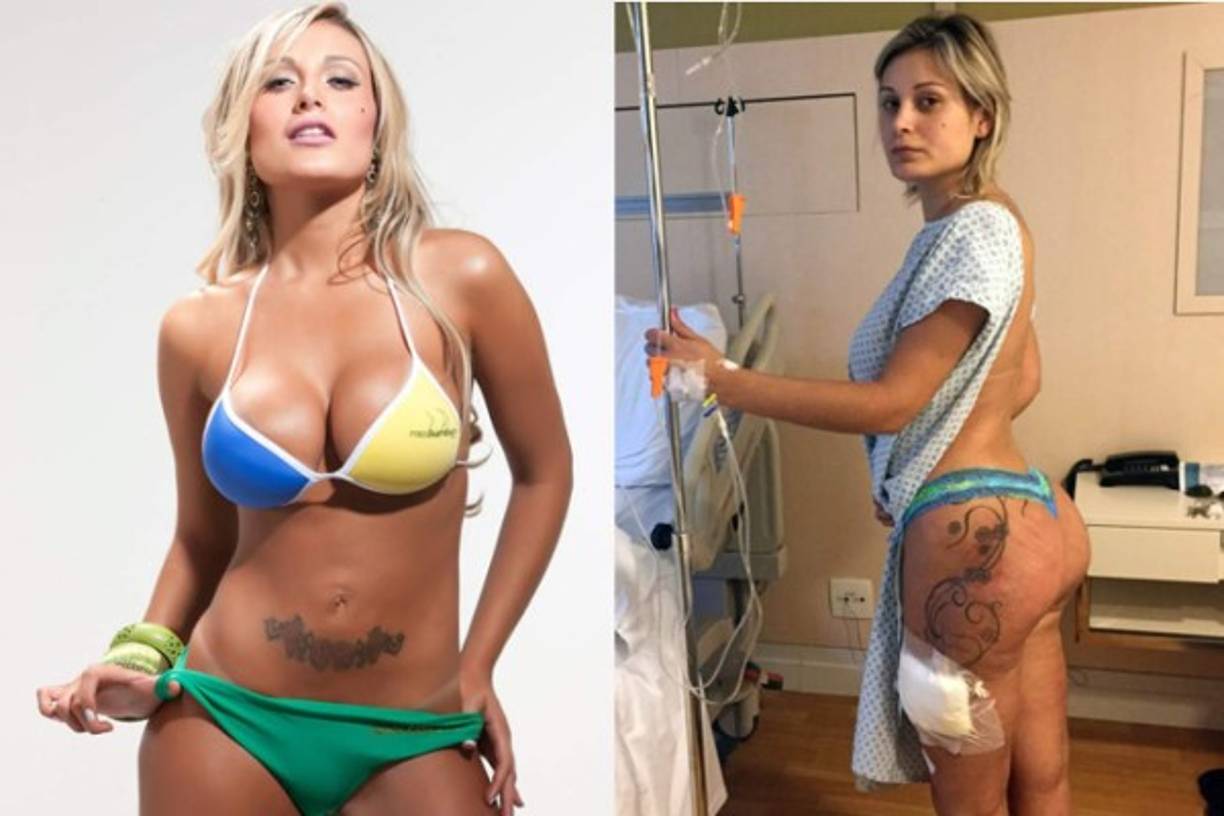 Muchas de las participantes arriesgan todo por ser las el derriere más deseado de Brasil, y no es el premio en metal que viene con el título lo que tanto anhelan, si no la fama posterior a la corona. Un ejemplo es Andressa Urach, que se convirtió en modelo y presentadora de televisión después de participar en el concurso.<br/><br/>Pero no todo fue color de rosa, Andressa dijo en una entrevista 'Que se arrepiente de que la fama la hubiese convertido en una máquina de hacer dinero', en la misma entrevista la modelo confesó haberse prostituido; solo fue cuando estuvo al borde dela muerte, por una mala cirugía, que reevaluó su vida.