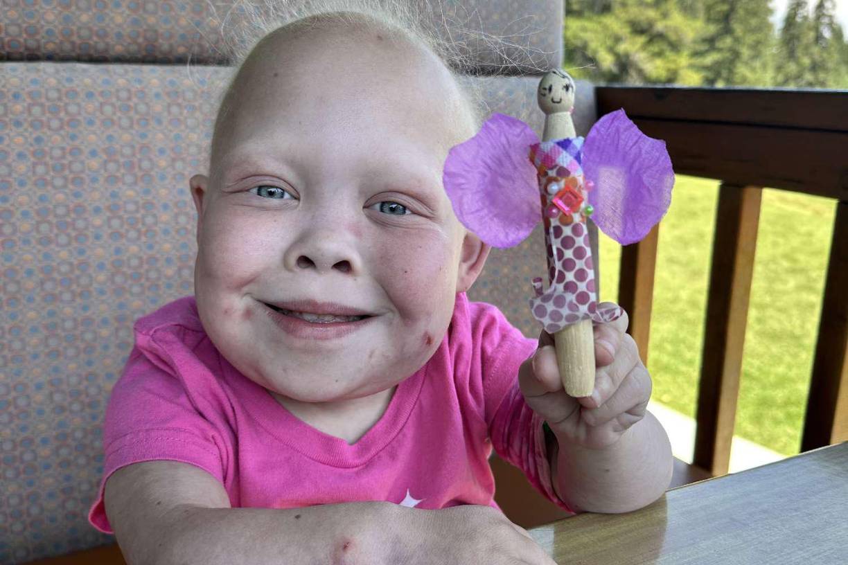 La joven padecía tres enfermedades raras desde su nacimiento: enanismo, enfermedad de Hirschsprung e inmunodeficiencia combinada grave. Estas condiciones médicas le provocaron múltiples problemas de salud durante sus años de vida.