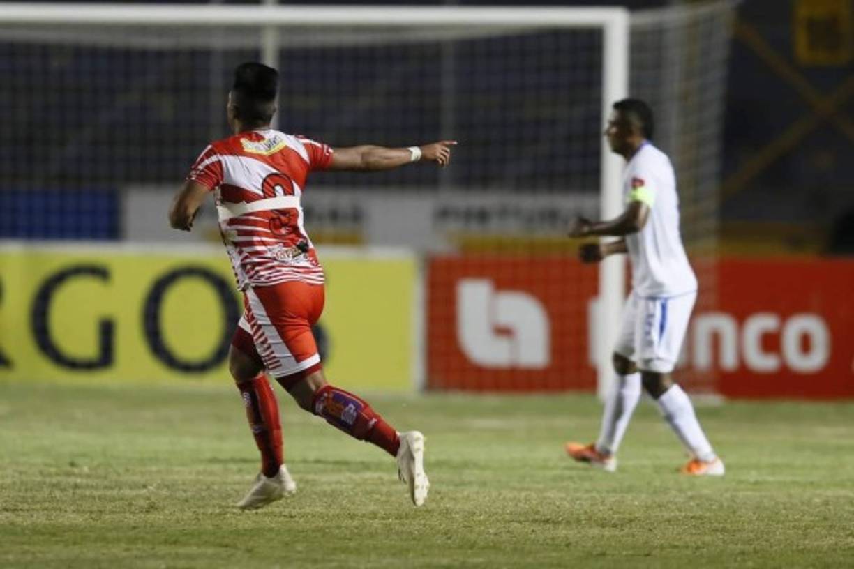 Un hecho insólito se dio en el partido Olimpia-Vida. Al jugador cocotero Jesús Rivera se le rompió la camiseta, pero la delegación ceibeña solo andaba un uniforme (con el que estaban jugando) y le tuvieron que poner cinta adhesiva para que siguiera en el partido.